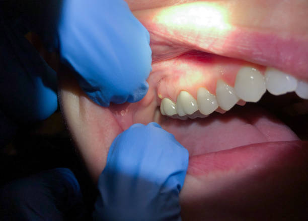 Best Emergency Treatment for Jaw Pain or Injury in Jackson, KY